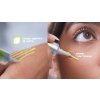 1678 3 retinal shot tightening booster 2