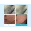 1753 azelaic acid niacinamide clear toner 5