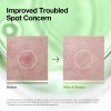 1756 3 azelaic acid 3 cica skin clarifying toner 2