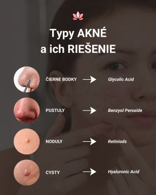 Akné má mnoho podôb a každý typ si vyžaduje iný prístup. 👌 Správne zvolené aktívne látky dokážu pleť upokojiť a obnoviť...